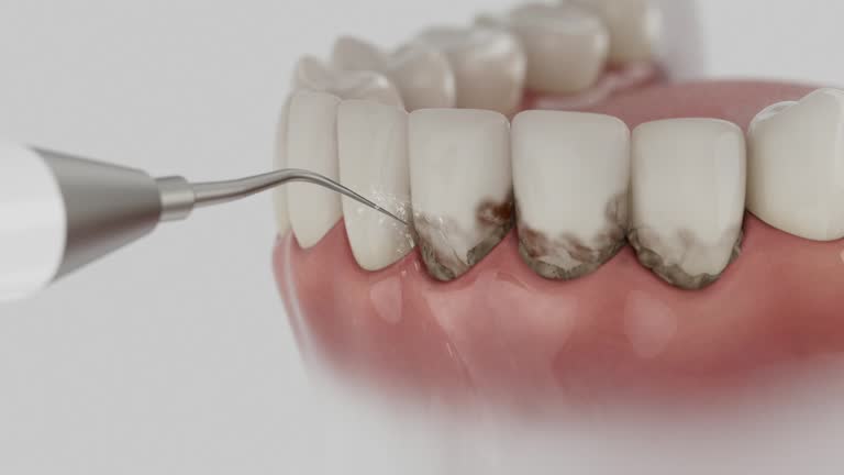 Reliable Tooth Extraction contractor in Bowie County County, TX by Dentist Open Now